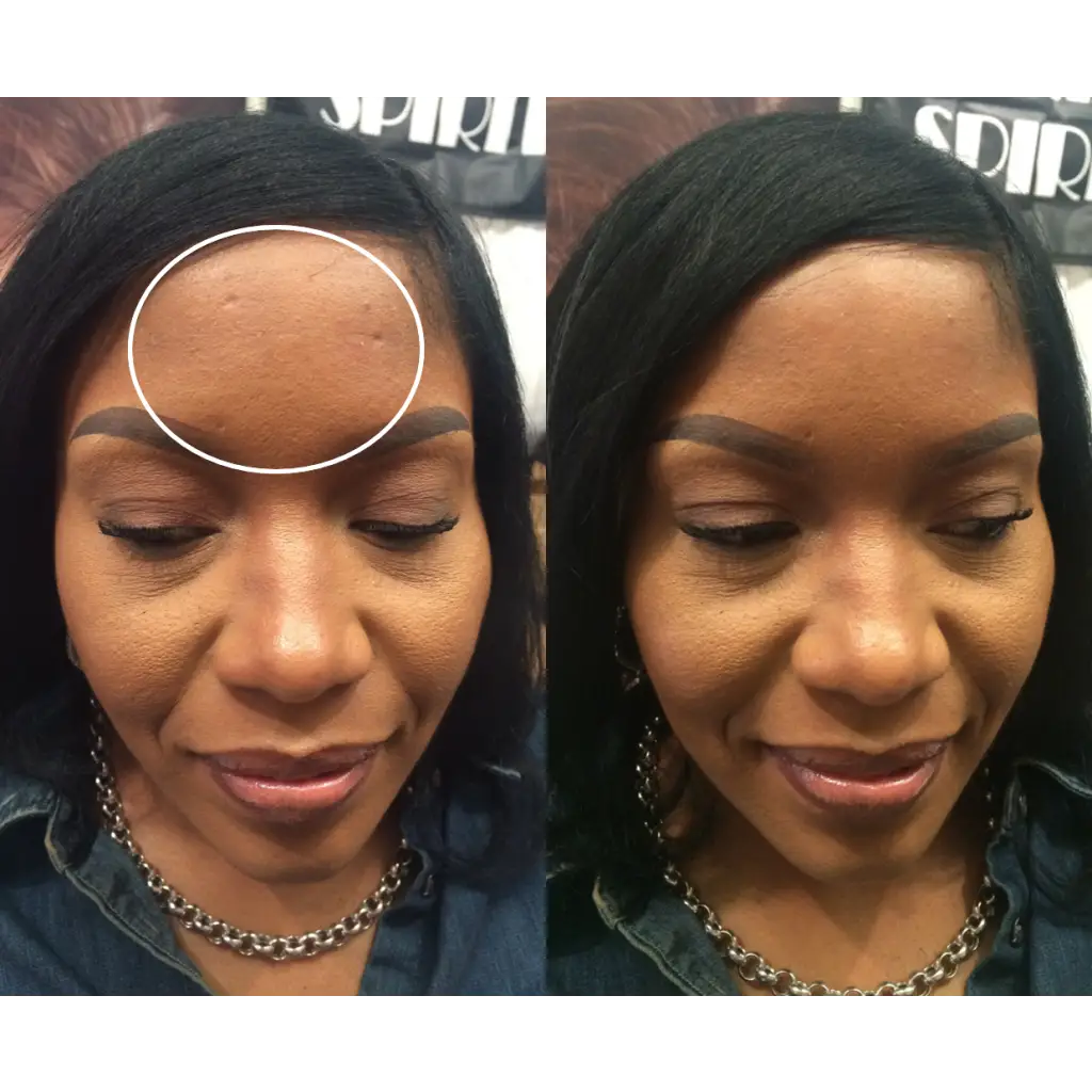 makeup to cover scars
