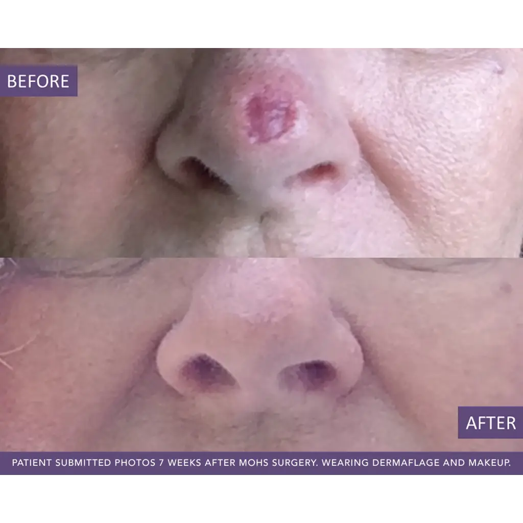 Makeup to cover scars