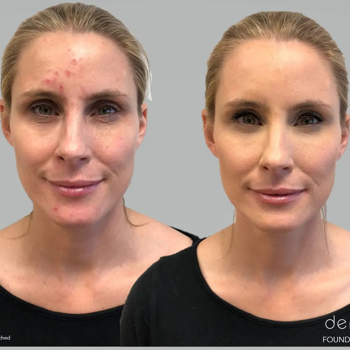 FOUNDER OF DERMAFLAGE