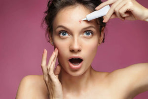 Is Acne Unwanted in the Movie Industry?