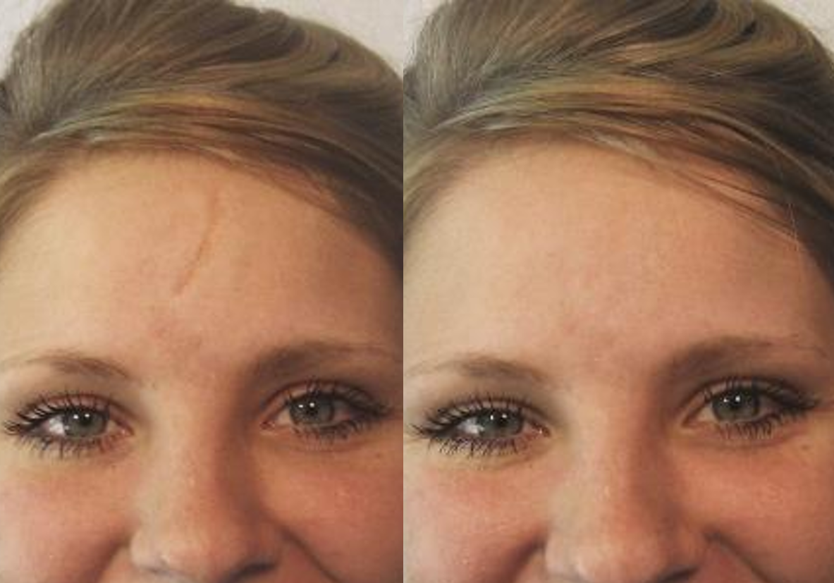 Make up to cover scars