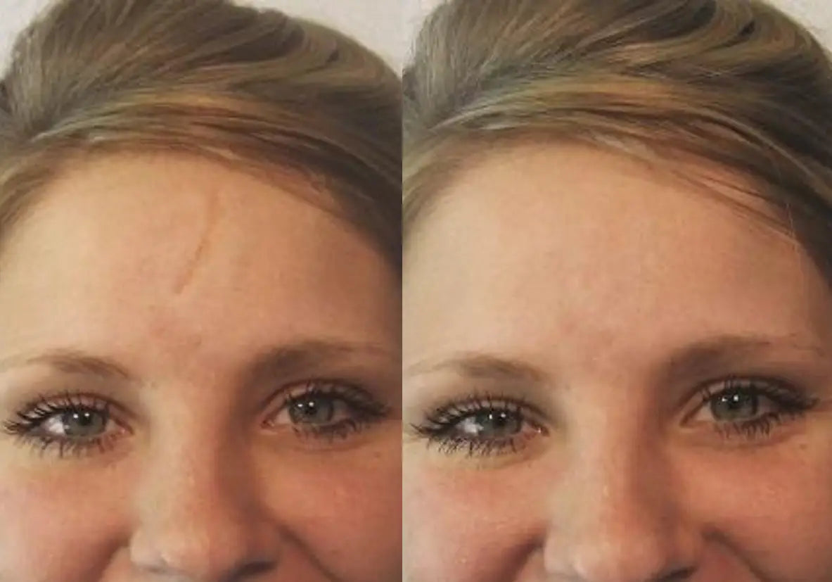 Make up to cover scars