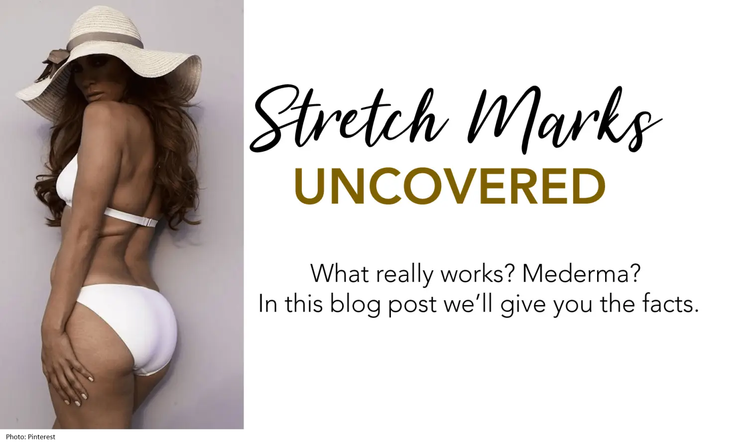 Mederma Stretch Mark Cream
