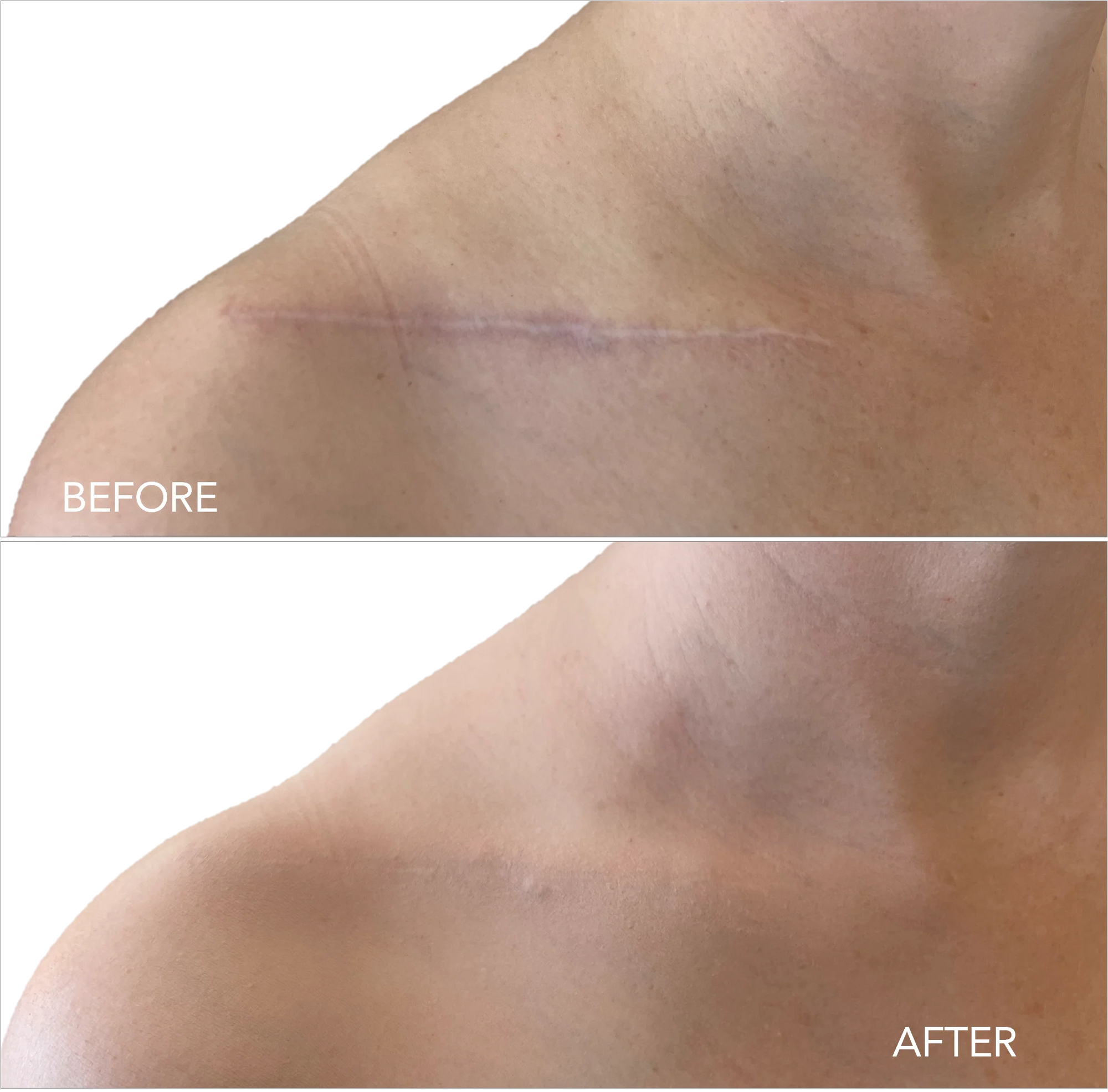 Scar Makeup the Way it Should Be