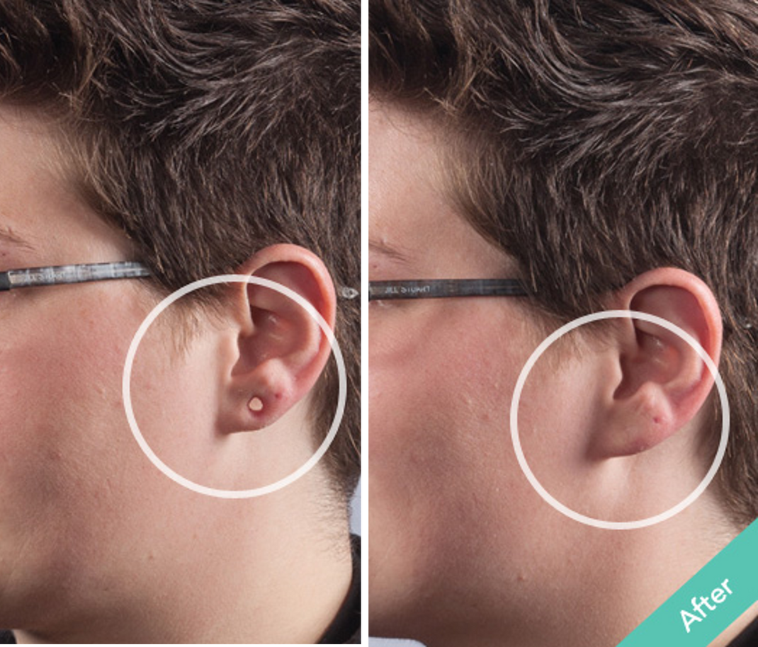 How to Hide a Nose Piercing? Makeup to Fill in Piercing Holes