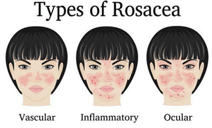 makeup for rosacea