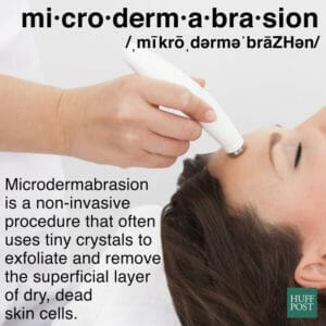 microdermabrasion