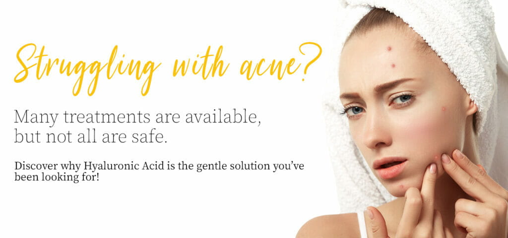 Struggling with acne?
Many treatments are available, but not all are safe.
Discover why Hyaluronic Acid is the gentle solution you’ve been looking for!
