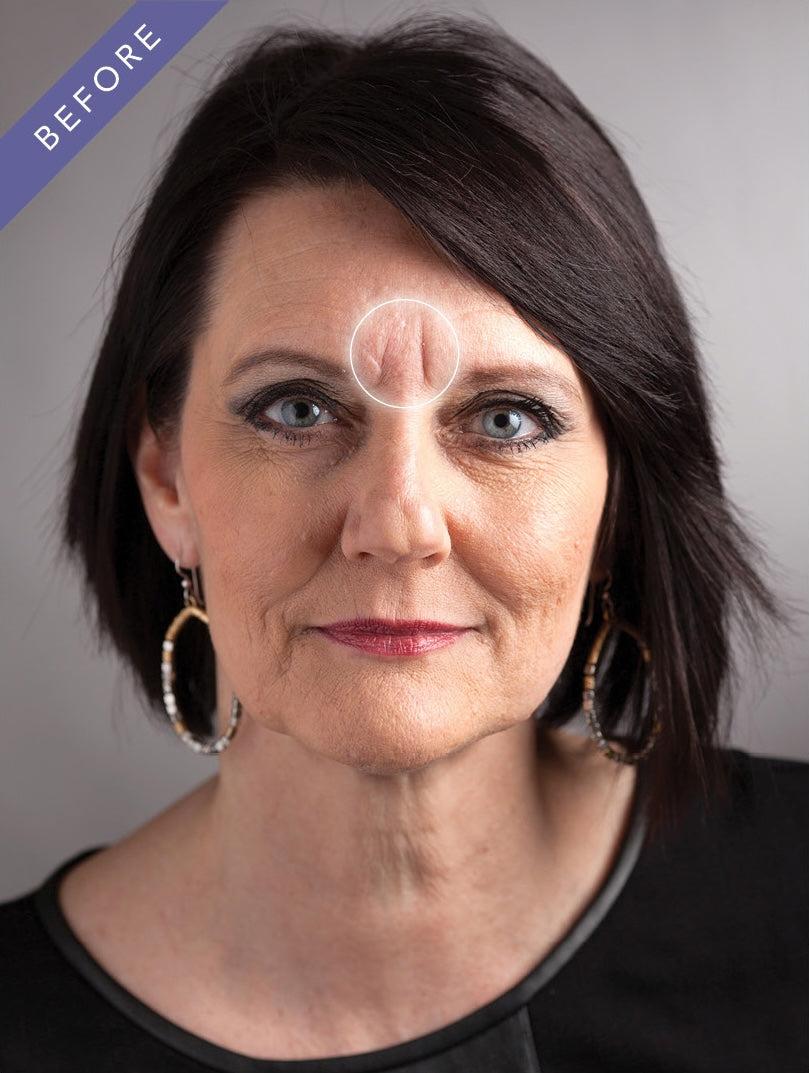 【予約専用ページ購入不可】 dermaflage Tattoo, Acne, Wrinkles and Scar Cover Up Makeup | Dermaflage